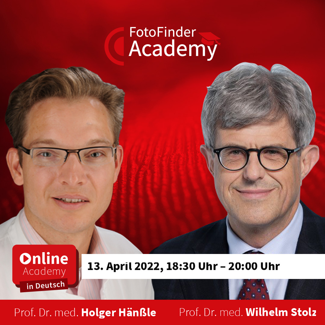 Zwei Experten – Doppelte Power in der Dermatoskopie
