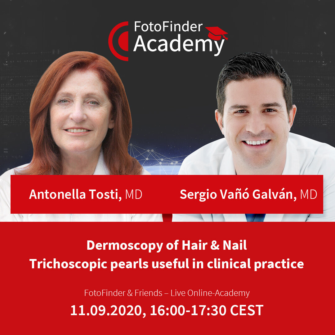 Dermoscopy of Hair – Trichoscopic pearls useful in clinical practice