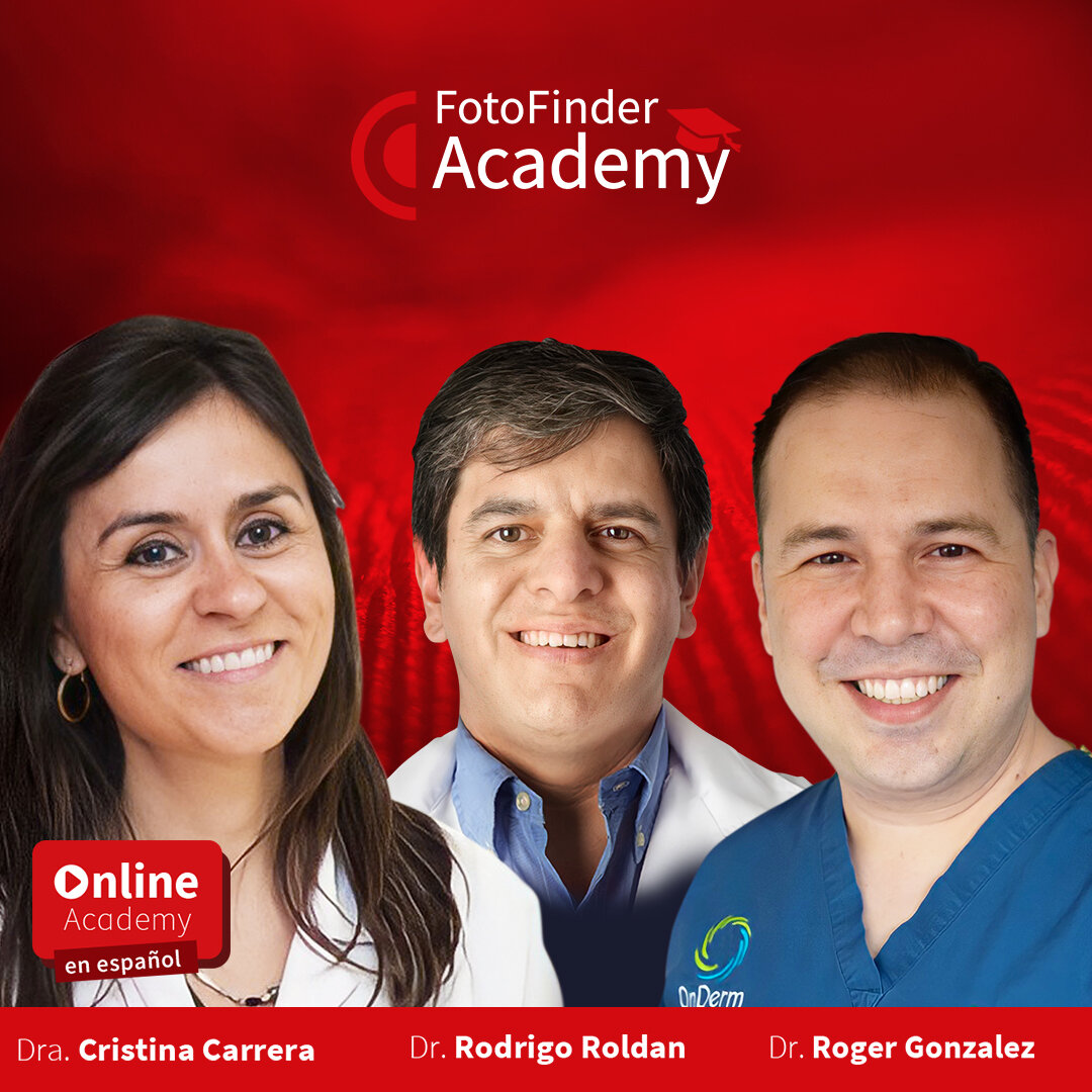 Casos prácticos de detección precoz del cáncer de piel