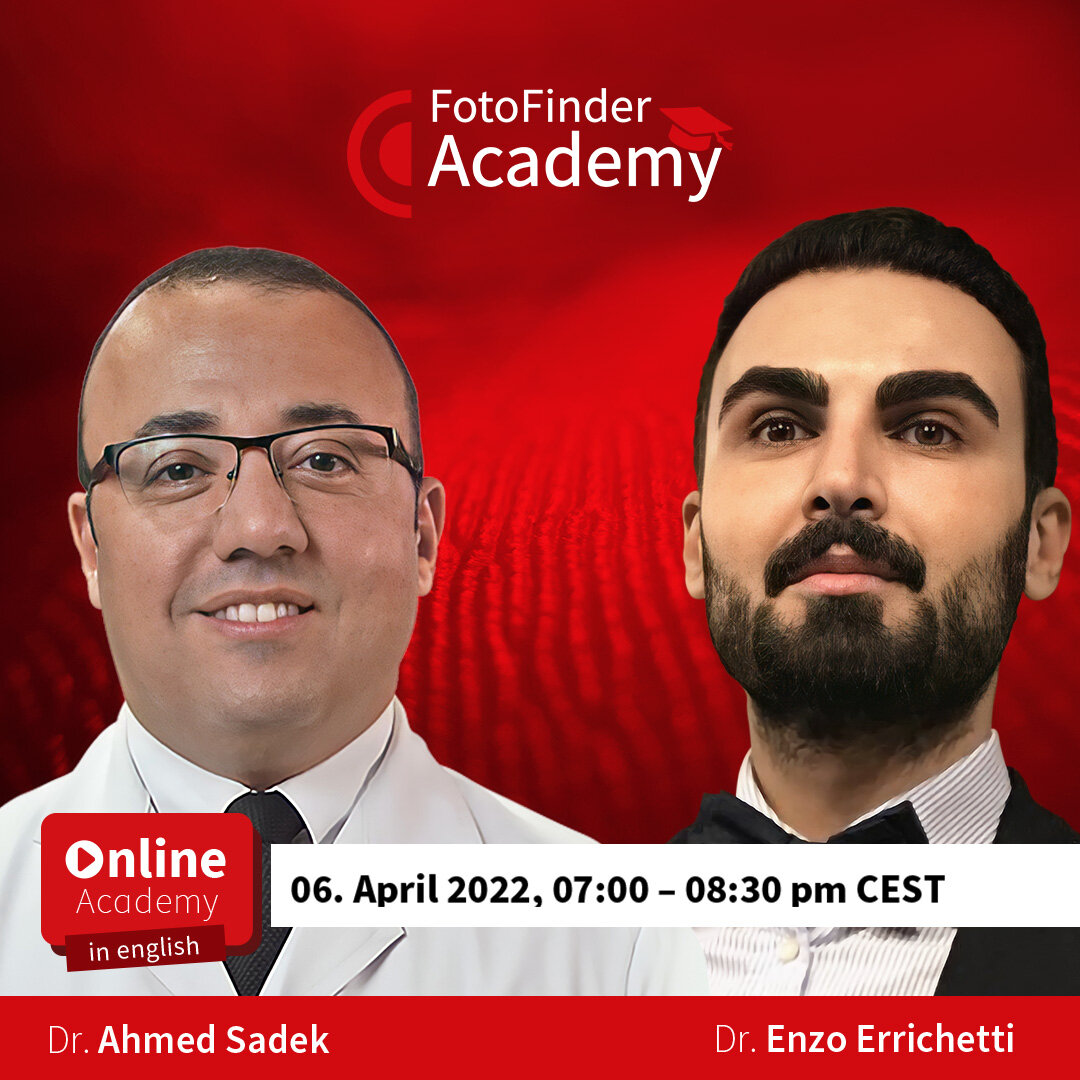 Dermoscopy of Skin of Color