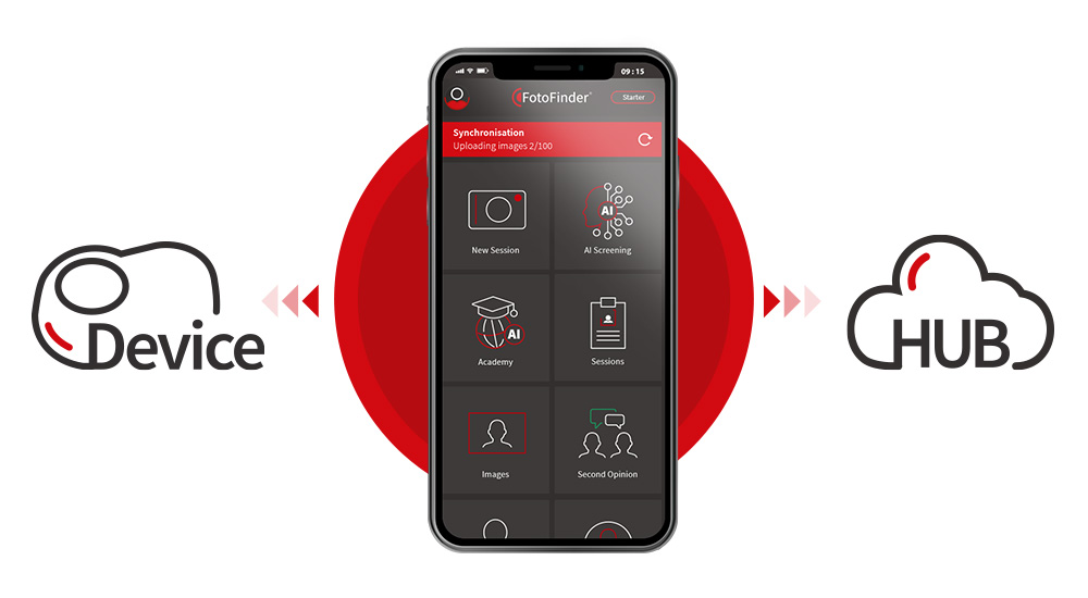 FotoFinder handyscope pro app