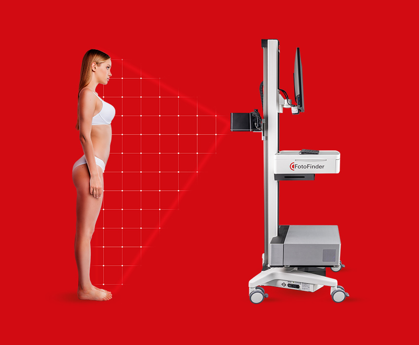    FotoFinder Systems PASIvision image capturing procedure