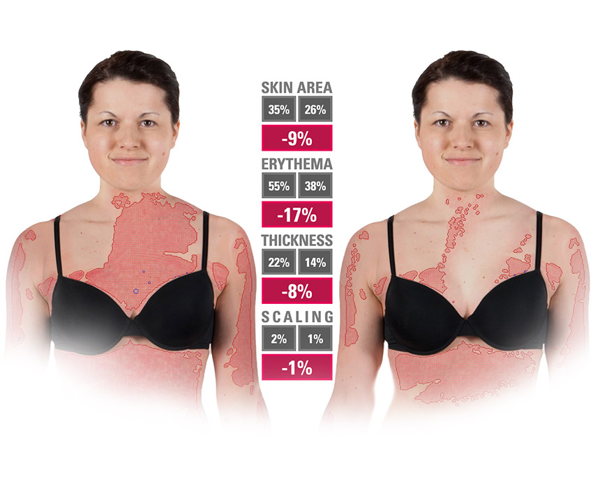 FotoFinder Systems PASIvision Body surface analysis
