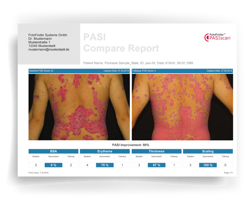  FotoFinder Systems PASIvision Report